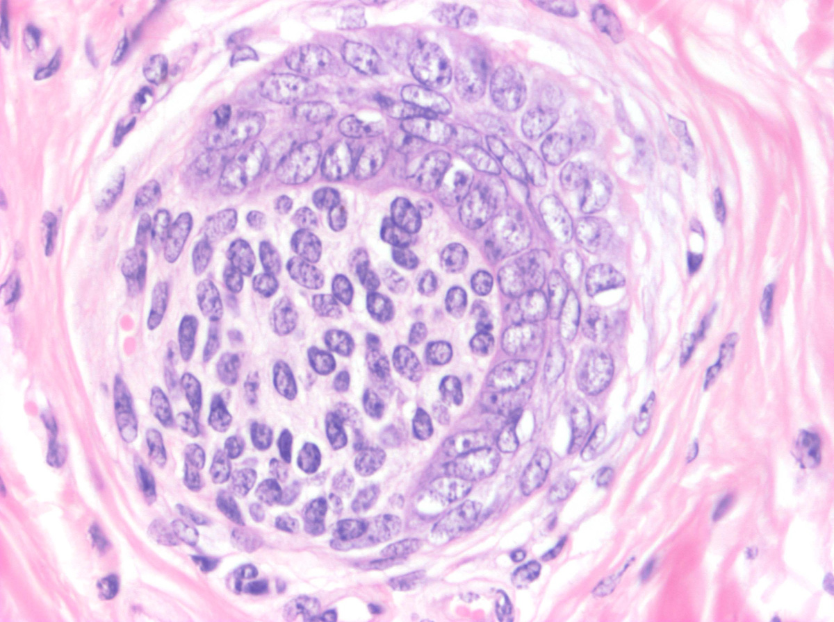 histología del folículo piloso