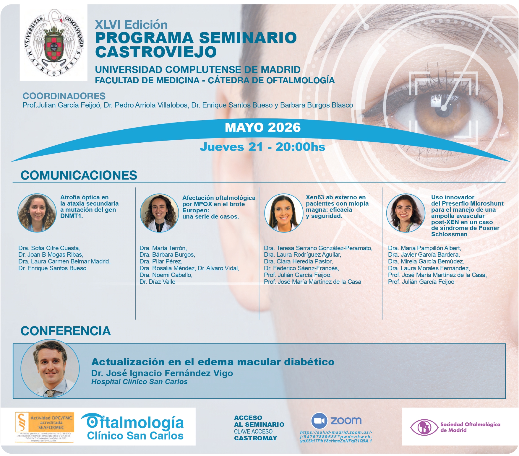 Seminario Castroviejo 21 de mayo 2026: Actualización en el edema macular diabético