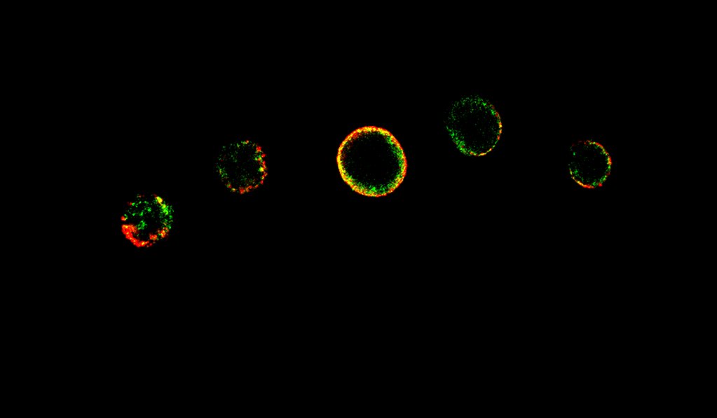 Human CD4+CD45RA+ T Cells Behavior after In Vitro Activation: Modulatory Role of Vasoactive Intestinal Peptide