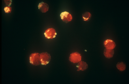 leishmaniosis_lab procesado muestras 1