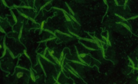 leishmaniosis_lab procesado muestras 2