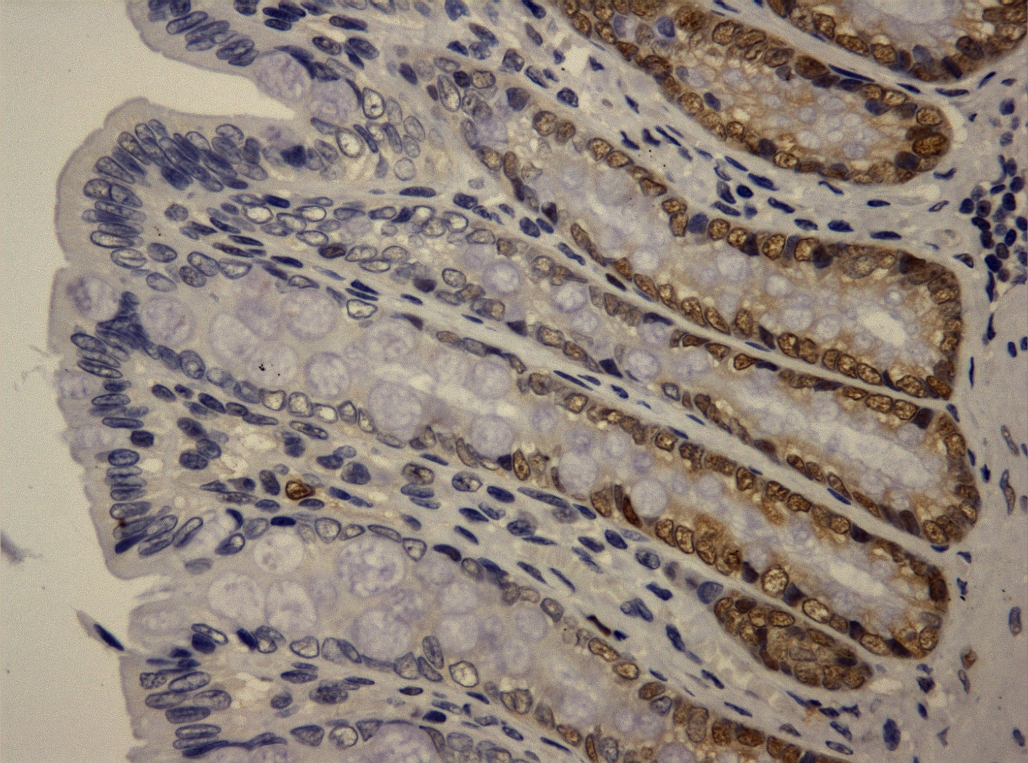 Proliferación celular colónica en un modelo animal de Diabetes Mellitus tipo 2
