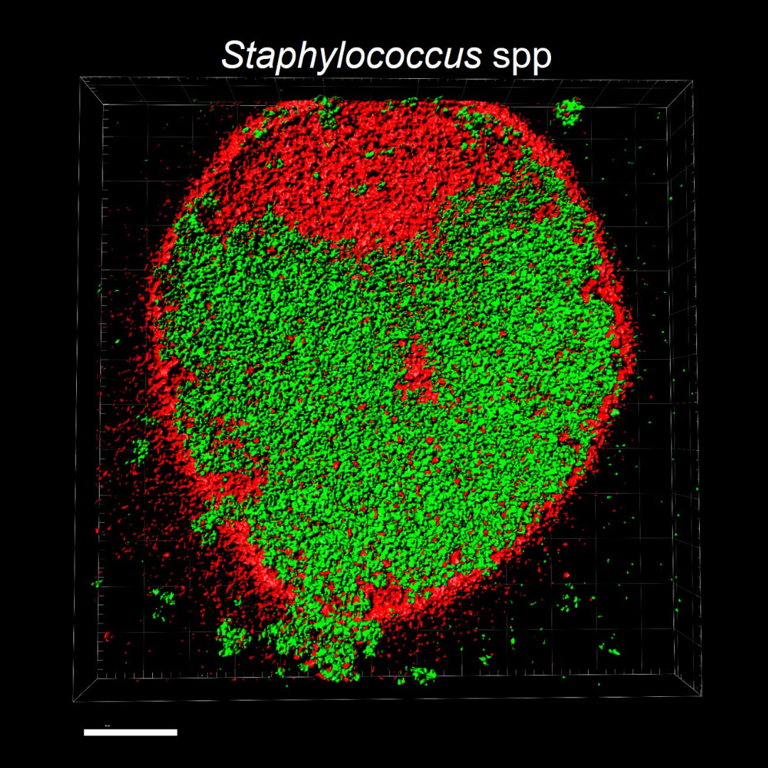 biofilm4