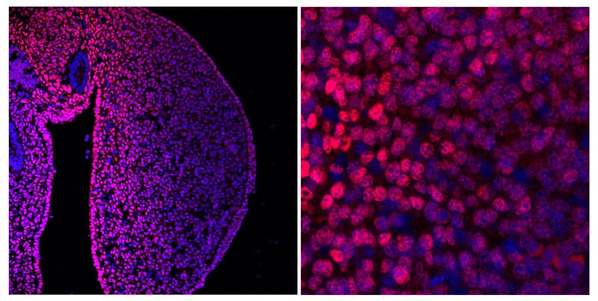 Sección de un primordio de extremidad mostrando en rosa la proteína Meis. En el aumento se aprecian los ditintos niveles de Meis en cada célula.